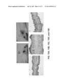 THE USE OF ALKYLATED SEMI-SYNTHETIC GLYCOSAMINOGLYCOSAN ETHERS FOR THE     TREATMENT OF DENTAL DISORDERS diagram and image