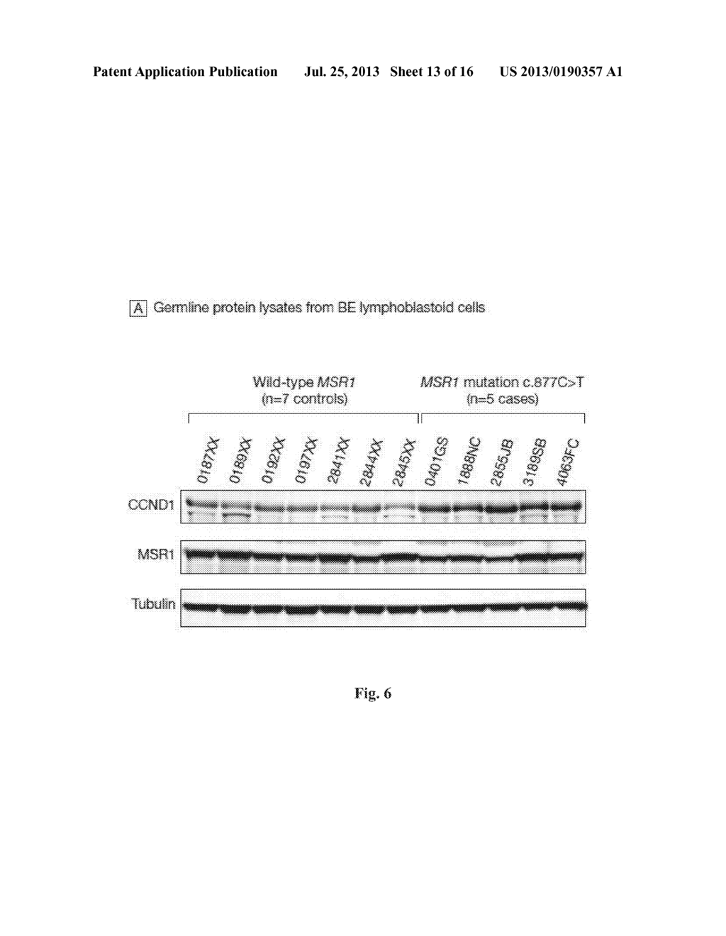 COMPOSITIONS AND METHODS FOR ASSESSING AND TREATING A PRECURSOR LESION     AND/OR ESOPHAGEAL CANCER - diagram, schematic, and image 14