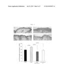 NOVEL COMPOUND ACCELERATING SECRETION OF HUMAN-DERIVED ANTI-MICROBIAL     PEPTIDE, METHOD FOR PREPARING SAME, AND COMPOSITION HAVING SAME AS ACTIVE     INGREDIENT diagram and image