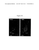 Methods Of Treating Autism With mGluR5 Antagonists diagram and image