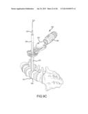 Lateral Retractor System and Methods of Use diagram and image