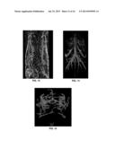 Laser Optoacoustic Ultrasonic Imaging System (LOUIS) and Methods of Use diagram and image