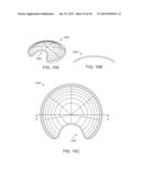 Histotripsy Therapy Transducer diagram and image