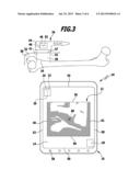 METHOD AND APPARATUS FOR DISPLAYING AN ULTRASOUND IMAGE diagram and image