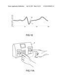 CALIBRATION METHOD OF ELECTROCARDIOGRAM SIGNALS AND THE APPLICATION     PROGRAM FOR THE SAME diagram and image