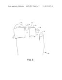 Device for correcting an underlapping or overlapping toe or finger diagram and image