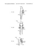 NERVE TREATMENT SYSTEM diagram and image