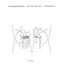 NERVE TREATMENT SYSTEM diagram and image