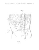 NERVE TREATMENT SYSTEM diagram and image