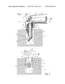 Laser system for the treatment of body tissue diagram and image