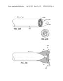 DISSECTION HANDPIECE AND METHOD FOR REDUCING THE APPEARANCE OF CELLULITE diagram and image