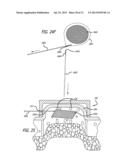 DISSECTION HANDPIECE AND METHOD FOR REDUCING THE APPEARANCE OF CELLULITE diagram and image