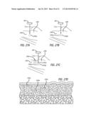 DISSECTION HANDPIECE AND METHOD FOR REDUCING THE APPEARANCE OF CELLULITE diagram and image