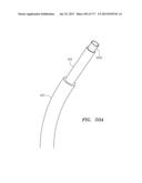 SYSTEMS AND METHODS FOR PERFORMING MINIMALLY INVASIVE PROCEDURES diagram and image