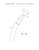 SYSTEMS AND METHODS FOR PERFORMING MINIMALLY INVASIVE PROCEDURES diagram and image