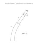 SYSTEMS AND METHODS FOR PERFORMING MINIMALLY INVASIVE PROCEDURES diagram and image