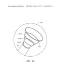 SYSTEMS AND METHODS FOR PERFORMING MINIMALLY INVASIVE PROCEDURES diagram and image