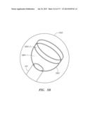 SYSTEMS AND METHODS FOR PERFORMING MINIMALLY INVASIVE PROCEDURES diagram and image