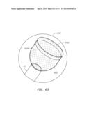 SYSTEMS AND METHODS FOR PERFORMING MINIMALLY INVASIVE PROCEDURES diagram and image