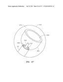 SYSTEMS AND METHODS FOR PERFORMING MINIMALLY INVASIVE PROCEDURES diagram and image