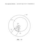 SYSTEMS AND METHODS FOR PERFORMING MINIMALLY INVASIVE PROCEDURES diagram and image