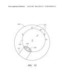 SYSTEMS AND METHODS FOR PERFORMING MINIMALLY INVASIVE PROCEDURES diagram and image