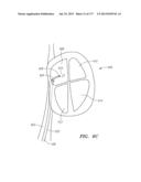 SYSTEMS AND METHODS FOR PERFORMING MINIMALLY INVASIVE PROCEDURES diagram and image