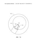 SYSTEMS AND METHODS FOR PERFORMING MINIMALLY INVASIVE PROCEDURES diagram and image