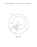 SYSTEMS AND METHODS FOR PERFORMING MINIMALLY INVASIVE PROCEDURES diagram and image