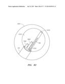 SYSTEMS AND METHODS FOR PERFORMING MINIMALLY INVASIVE PROCEDURES diagram and image