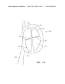 SYSTEMS AND METHODS FOR PERFORMING MINIMALLY INVASIVE PROCEDURES diagram and image