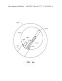 SYSTEMS AND METHODS FOR PERFORMING MINIMALLY INVASIVE PROCEDURES diagram and image