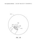 SYSTEMS AND METHODS FOR PERFORMING MINIMALLY INVASIVE PROCEDURES diagram and image