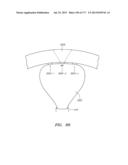 SYSTEMS AND METHODS FOR PERFORMING MINIMALLY INVASIVE PROCEDURES diagram and image