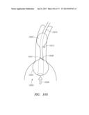 SYSTEMS AND METHODS FOR PERFORMING MINIMALLY INVASIVE PROCEDURES diagram and image