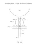 SYSTEMS AND METHODS FOR PERFORMING MINIMALLY INVASIVE PROCEDURES diagram and image