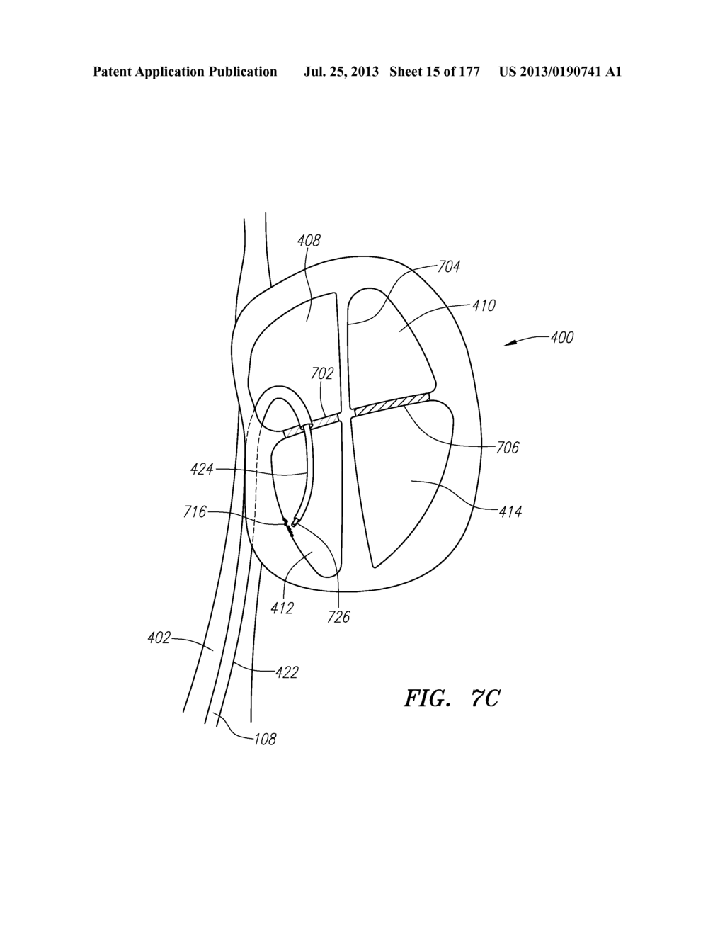 SYSTEMS AND METHODS FOR PERFORMING MINIMALLY INVASIVE PROCEDURES - diagram, schematic, and image 16