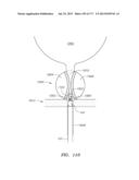 SYSTEMS AND METHODS FOR PERFORMING MINIMALLY INVASIVE PROCEDURES diagram and image