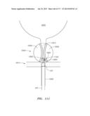 SYSTEMS AND METHODS FOR PERFORMING MINIMALLY INVASIVE PROCEDURES diagram and image