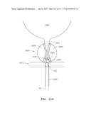 SYSTEMS AND METHODS FOR PERFORMING MINIMALLY INVASIVE PROCEDURES diagram and image