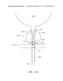 SYSTEMS AND METHODS FOR PERFORMING MINIMALLY INVASIVE PROCEDURES diagram and image