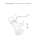 SYSTEMS AND METHODS FOR PERFORMING MINIMALLY INVASIVE PROCEDURES diagram and image