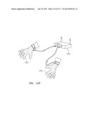 SYSTEMS AND METHODS FOR PERFORMING MINIMALLY INVASIVE PROCEDURES diagram and image