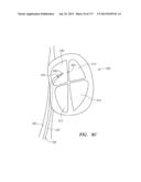 SYSTEMS AND METHODS FOR PERFORMING MINIMALLY INVASIVE PROCEDURES diagram and image