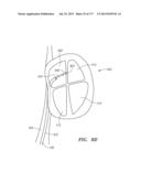 SYSTEMS AND METHODS FOR PERFORMING MINIMALLY INVASIVE PROCEDURES diagram and image