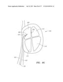 SYSTEMS AND METHODS FOR PERFORMING MINIMALLY INVASIVE PROCEDURES diagram and image