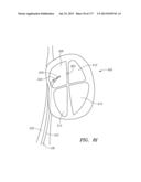 SYSTEMS AND METHODS FOR PERFORMING MINIMALLY INVASIVE PROCEDURES diagram and image