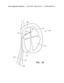 SYSTEMS AND METHODS FOR PERFORMING MINIMALLY INVASIVE PROCEDURES diagram and image