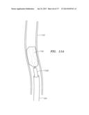 SYSTEMS AND METHODS FOR PERFORMING MINIMALLY INVASIVE PROCEDURES diagram and image