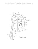 SYSTEMS AND METHODS FOR PERFORMING MINIMALLY INVASIVE PROCEDURES diagram and image